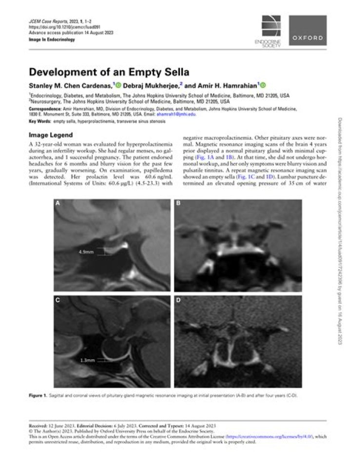 Can partially empty sella be reversed?