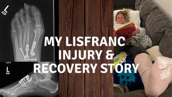Can you fully recover from Lisfranc surgery?