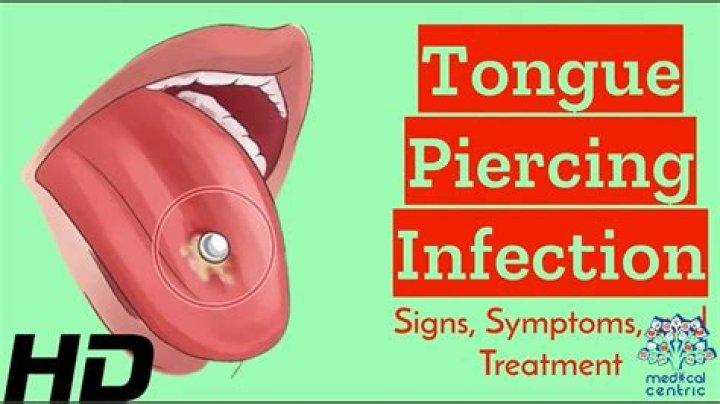 How likely is a tongue piercing to get infected?