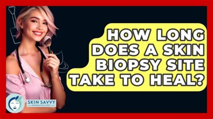 How long does it take for a throat biopsy to heal?