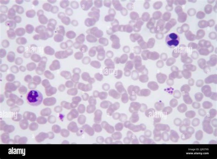 Is Plasmodium falciparum gram positive?