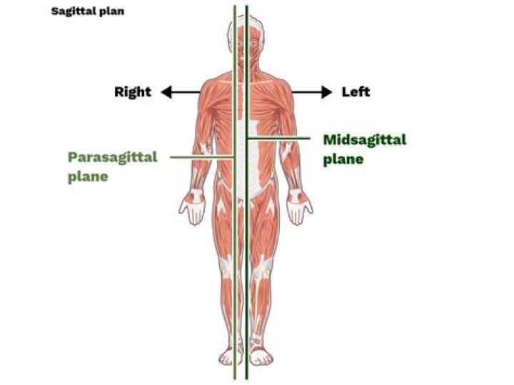 What is a sagittal view?