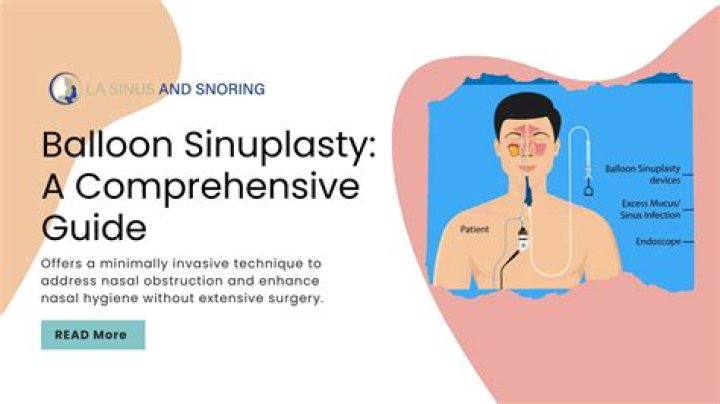 When do you do balloon sinuplasty?