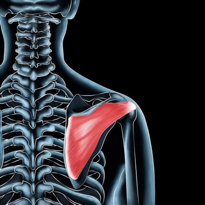 Where do you feel Infraspinatus pain?